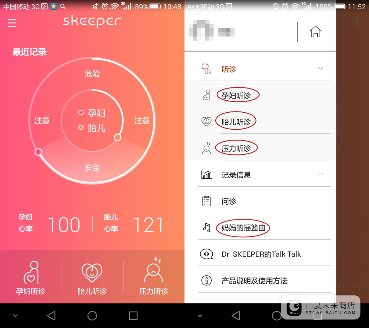 skeeper智康福智能心脏健康测试仪如何使用?skeeper粉色app 如何使用